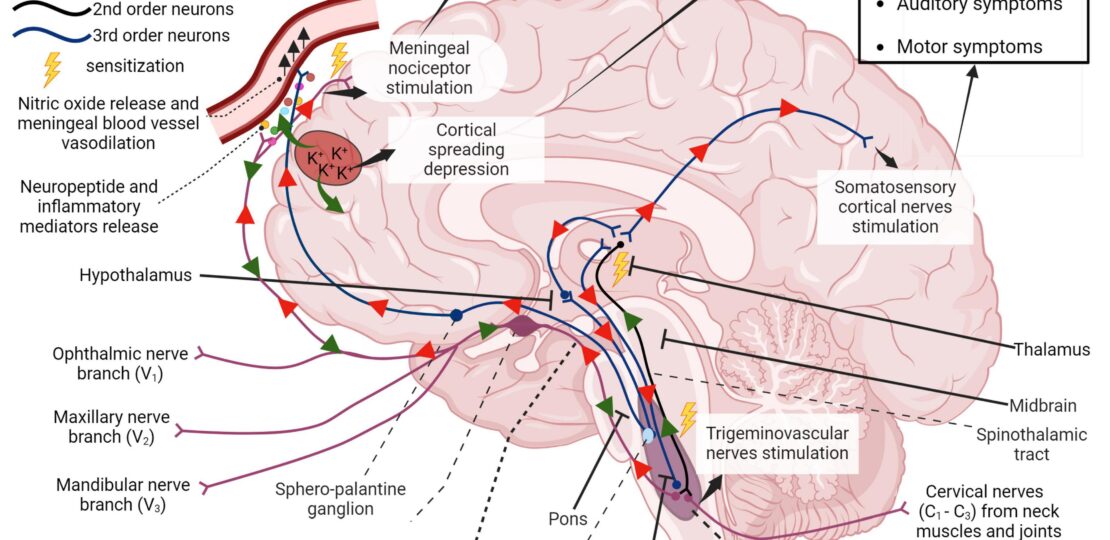 enxaqueca_fisiopatologia